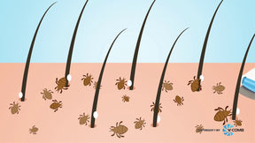 V com head lice
