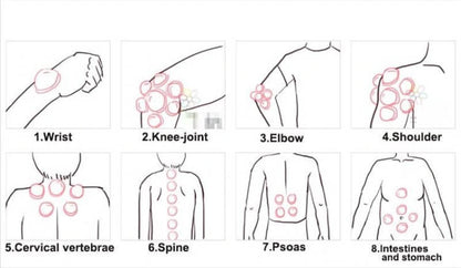 6pcs hijama cups chinese vacuum cupping kit